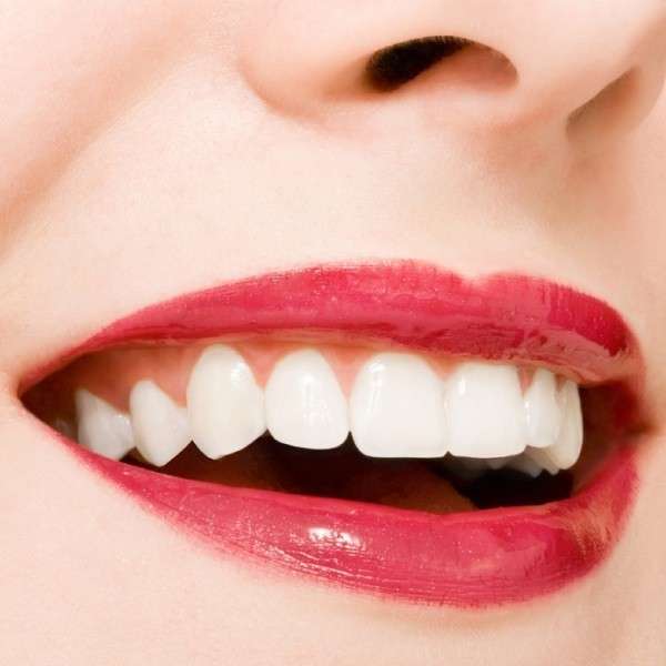Lấy vôi răng hai hàm