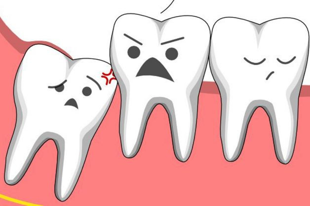 Nhổ răng số 8 hay răng khôn là một quyết định khó khăn đối với nhiều người. Tuy nhiên, trong một số trường hợp, việc nhổ răng này là cần thiết để ngăn chặn các vấn đề sức khỏe răng miệng nghiêm trọng. 