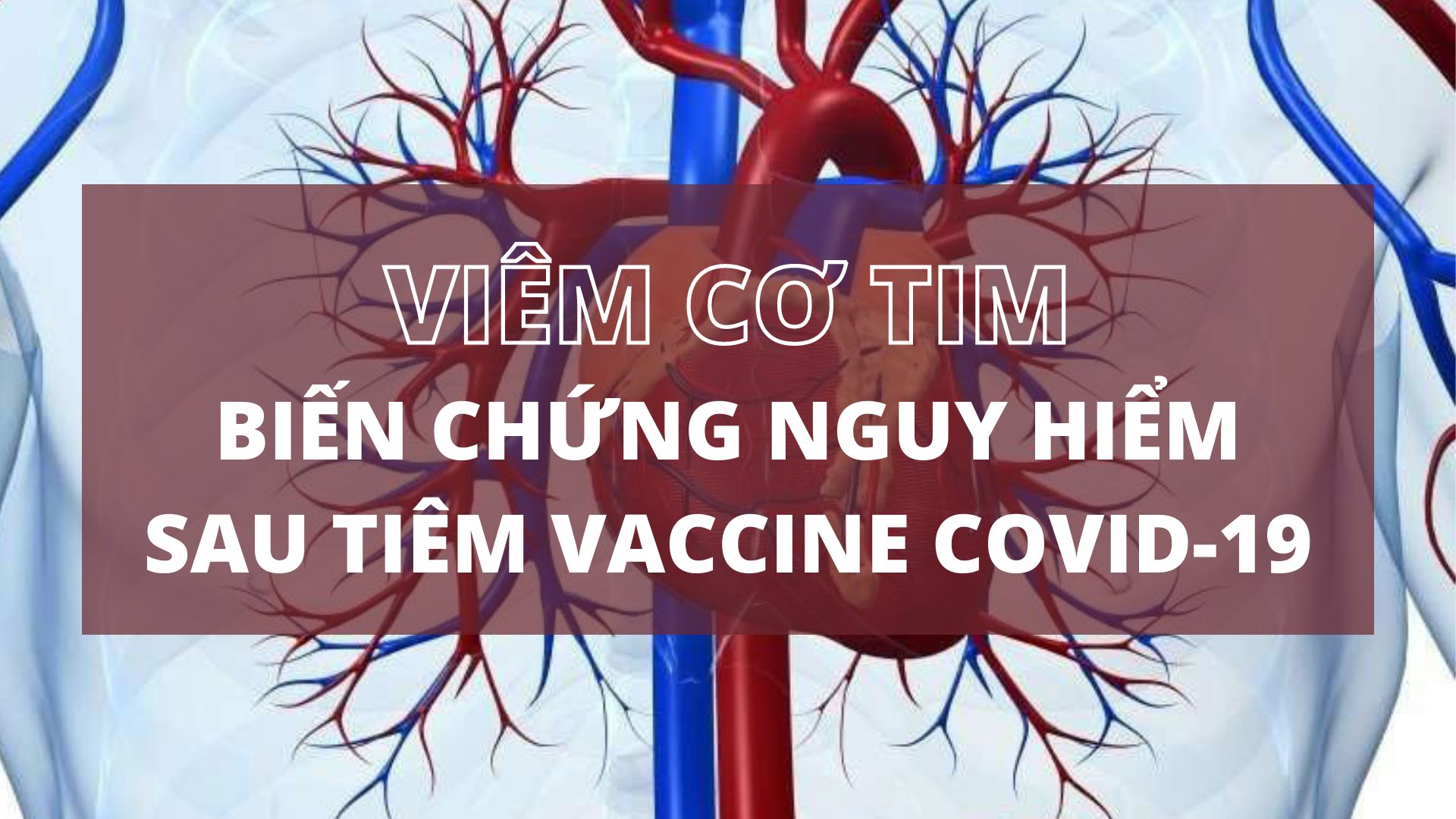 Viêm cơ tim – biến chứng nguy hiểm sau tiêm vaccine COVID-19