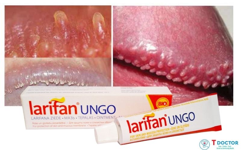 Kem bôi Larifan Ungo được khuyến cáo sử dụng