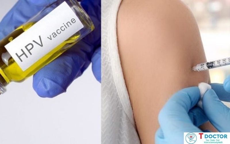 Tiêm phòng vaccine HPV là biện pháp hữu hiệu phòng ngừa ung thư cổ tử cung